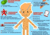 У Шевченкове Одеської області діагностували кір у 48 дітей