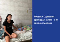 Медики Одещини врятували життя 11-ти місячної дитини